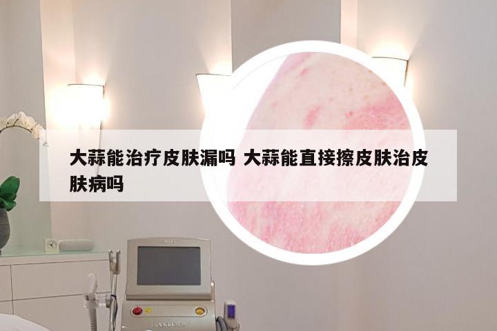 大蒜能治疗皮肤漏吗 大蒜能直接擦皮肤治皮肤病吗