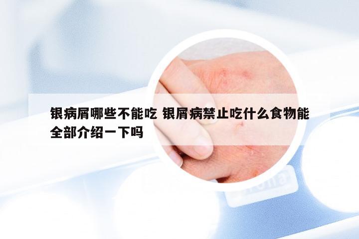 银病屑哪些不能吃 银屑病禁止吃什么食物能全部介绍一下吗