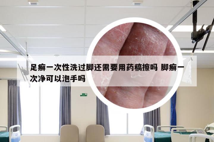 足癣一次性洗过脚还需要用药稿擦吗 脚癣一次净可以泡手吗