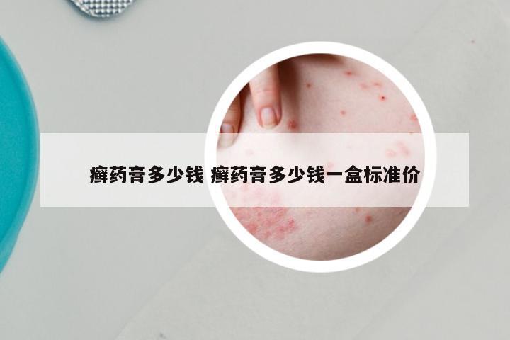 癣药膏多少钱 癣药膏多少钱一盒标准价