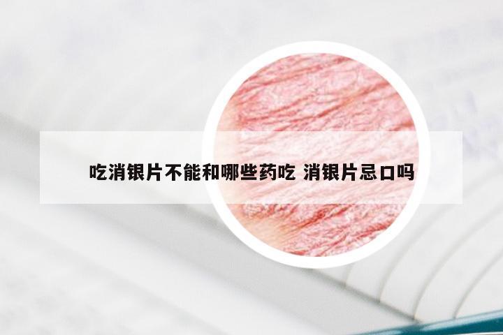 吃消银片不能和哪些药吃 消银片忌口吗