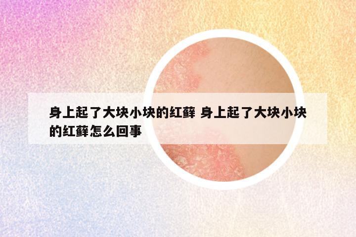 身上起了大块小块的红藓 身上起了大块小块的红藓怎么回事