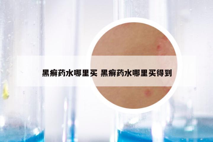 黑癣药水哪里买 黑癣药水哪里买得到