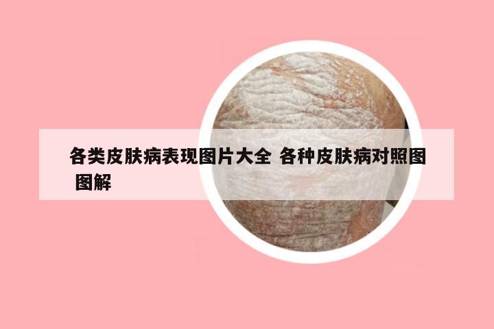 各类皮肤病表现图片大全 各种皮肤病对照图 图解
