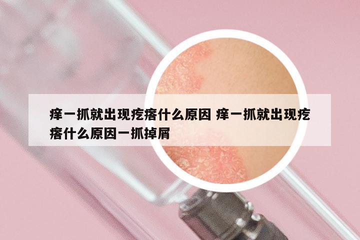 痒一抓就出现疙瘩什么原因 痒一抓就出现疙瘩什么原因一抓掉屑