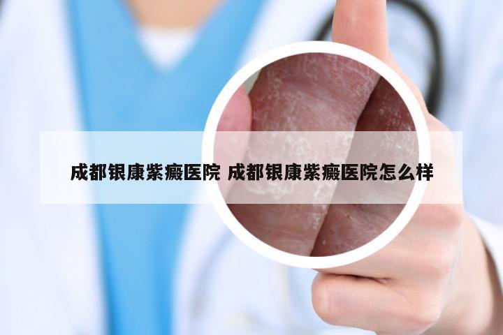 成都银康紫癜医院 成都银康紫癜医院怎么样