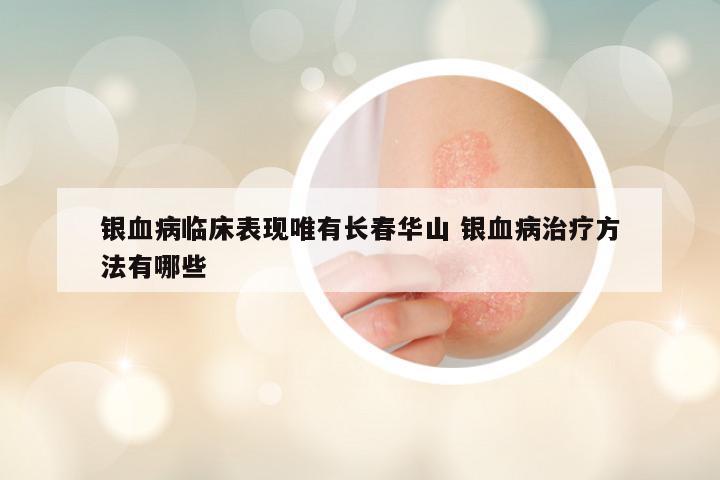 银血病临床表现唯有长春华山 银血病治疗方法有哪些