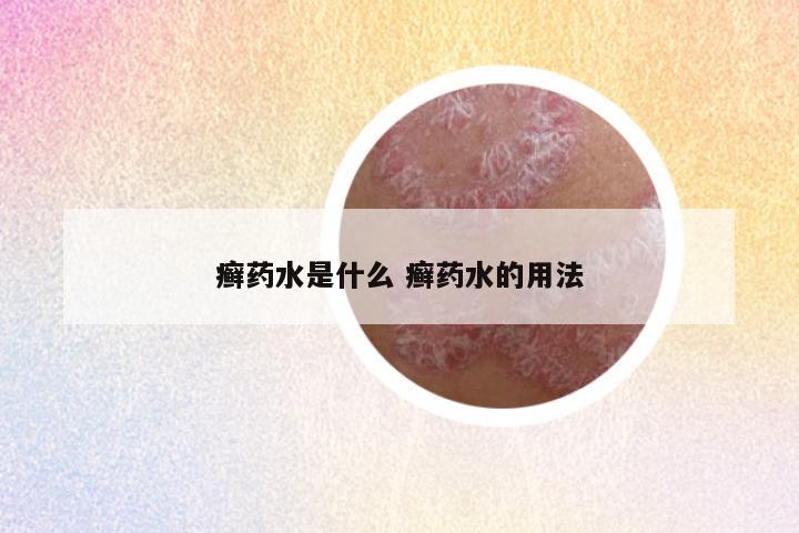 癣药水是什么 癣药水的用法