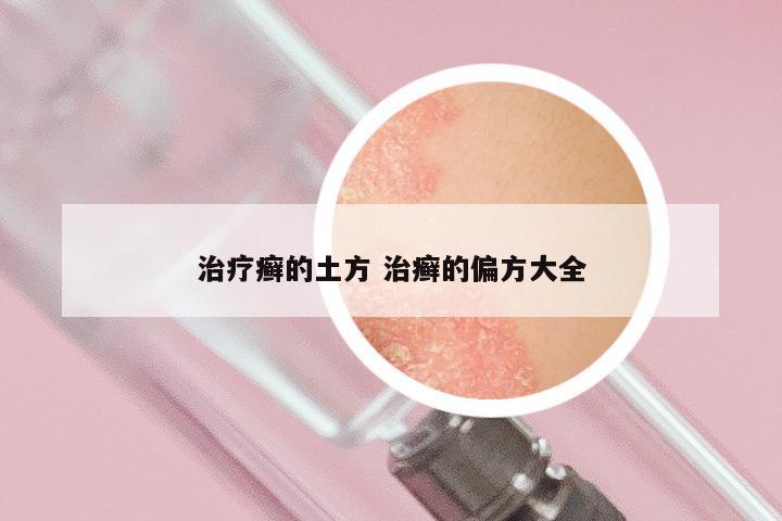 治疗癣的土方 治癣的偏方大全