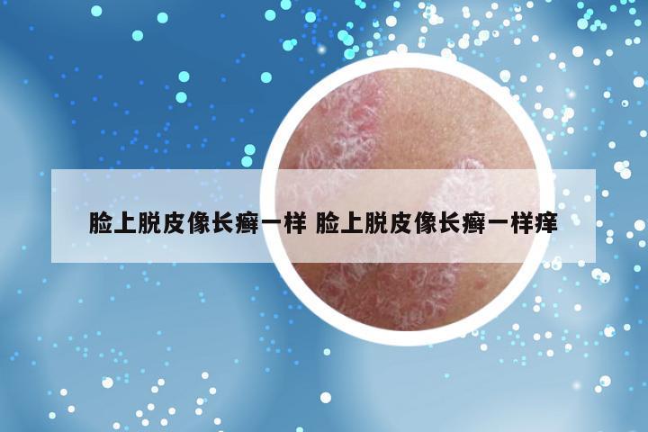 脸上脱皮像长癣一样 脸上脱皮像长癣一样痒