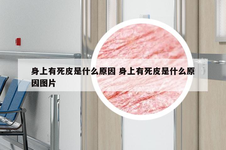 身上有死皮是什么原因 身上有死皮是什么原因图片