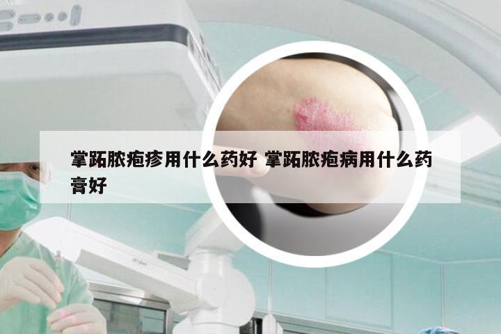 掌跖脓疱疹用什么药好 掌跖脓疱病用什么药膏好