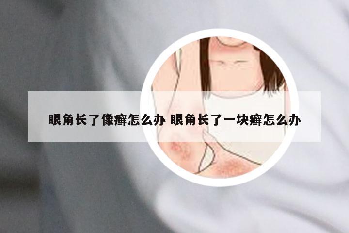 眼角长了像癣怎么办 眼角长了一块癣怎么办