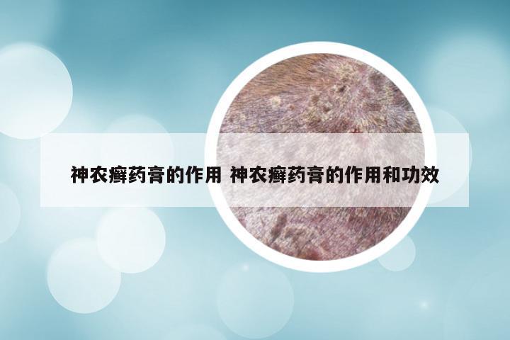 神农癣药膏的作用 神农癣药膏的作用和功效