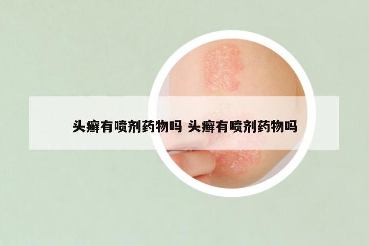 头癣有喷剂药物吗 头癣有喷剂药物吗