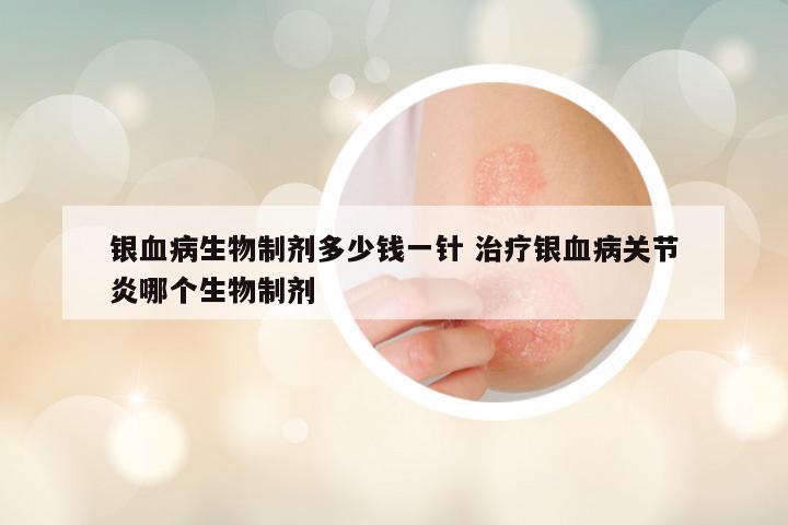 银血病生物制剂多少钱一针 治疗银血病关节炎哪个生物制剂