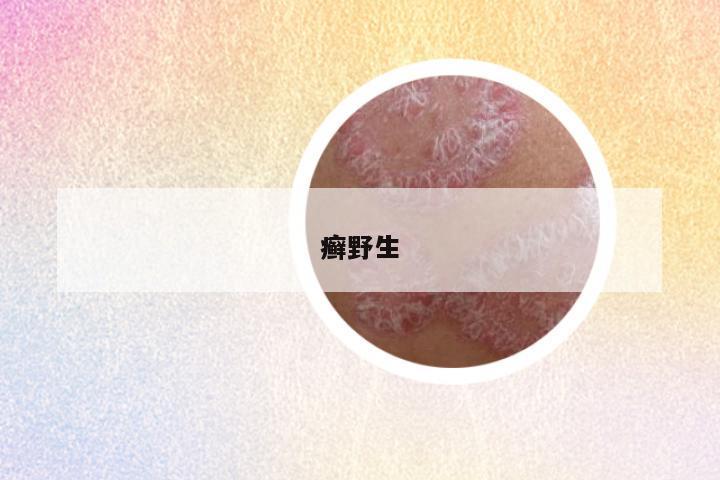 癣野生