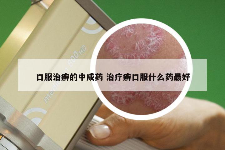 口服治癣的中成药 治疗癣口服什么药最好