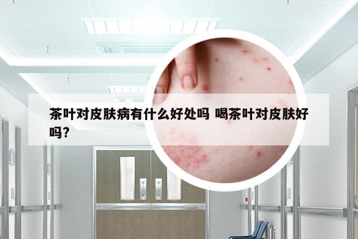 茶叶对皮肤病有什么好处吗 喝茶叶对皮肤好吗?
