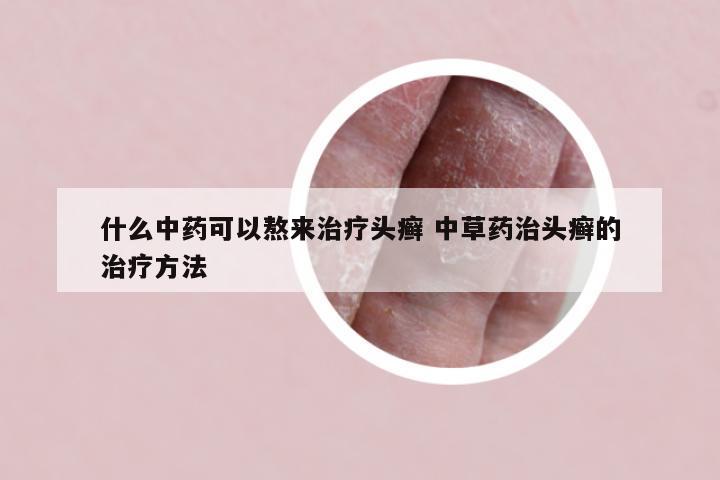 什么中药可以熬来治疗头癣 中草药治头癣的治疗方法