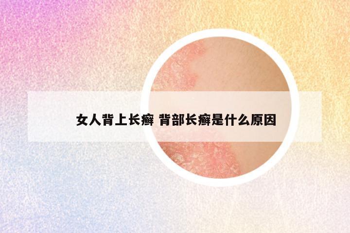 女人背上长癣 背部长癣是什么原因