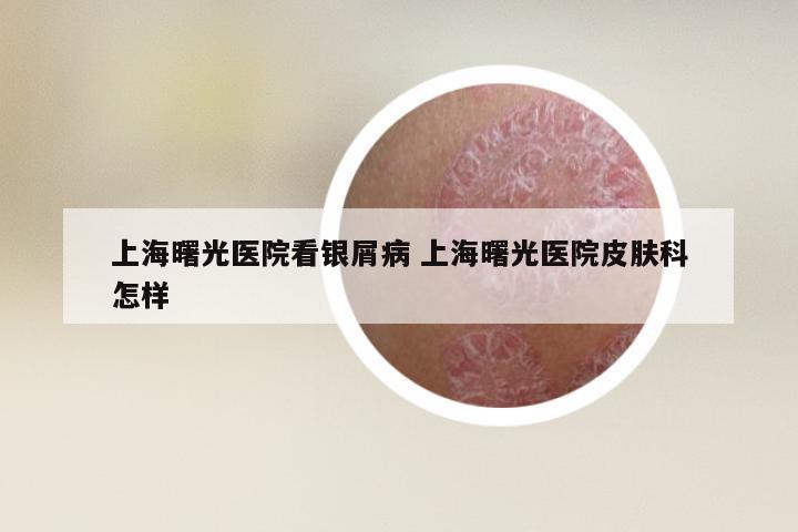 上海曙光医院看银屑病 上海曙光医院皮肤科怎样