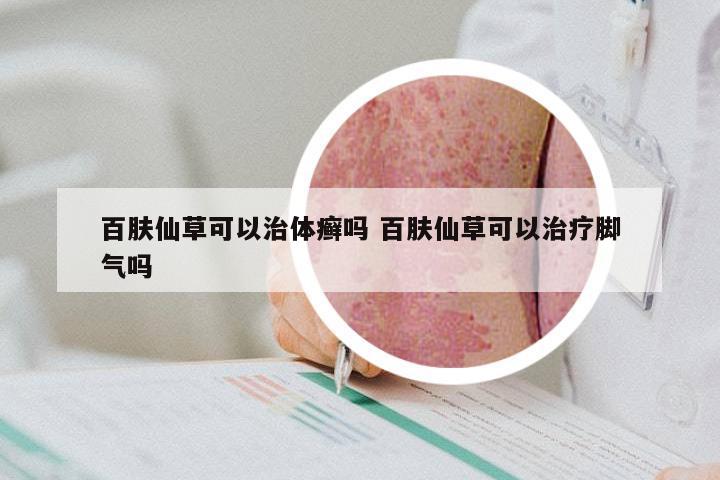 百肤仙草可以治体癣吗 百肤仙草可以治疗脚气吗