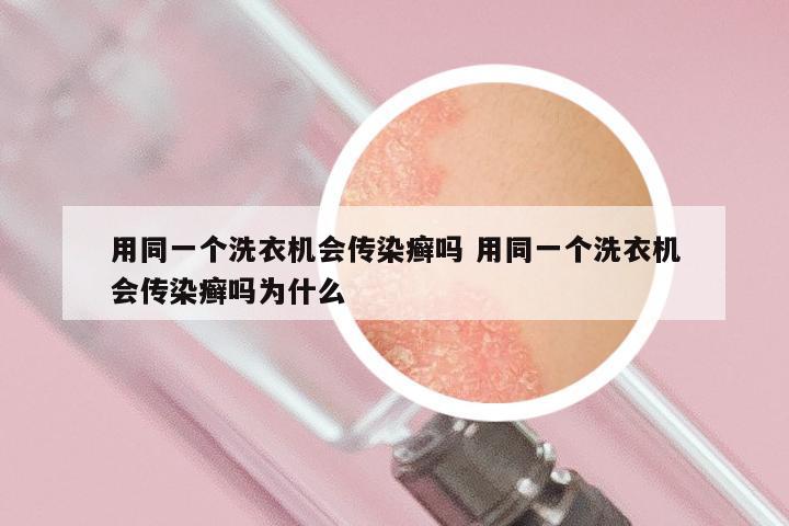 用同一个洗衣机会传染癣吗 用同一个洗衣机会传染癣吗为什么