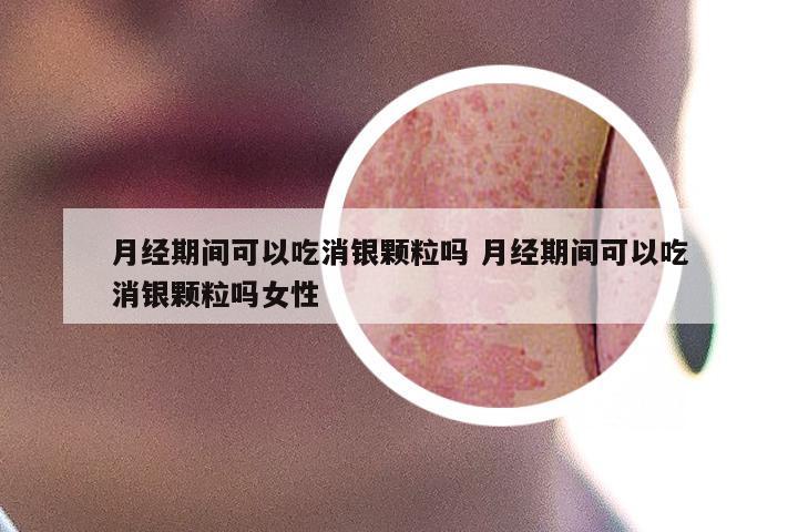 月经期间可以吃消银颗粒吗 月经期间可以吃消银颗粒吗女性