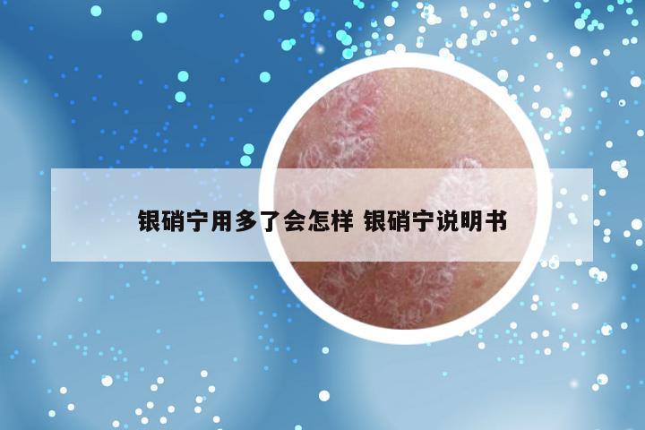 银硝宁用多了会怎样 银硝宁说明书