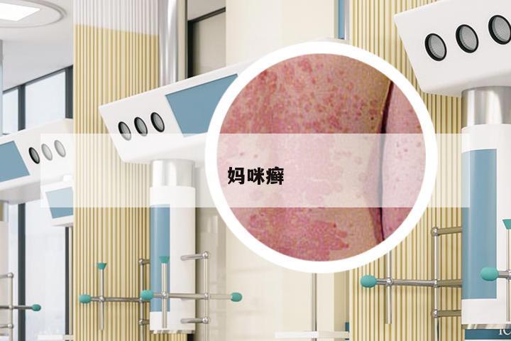 妈咪癣