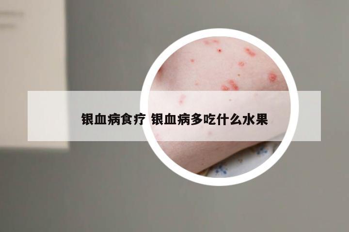 银血病食疗 银血病多吃什么水果
