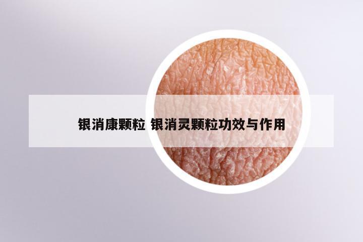 银消康颗粒 银消灵颗粒功效与作用