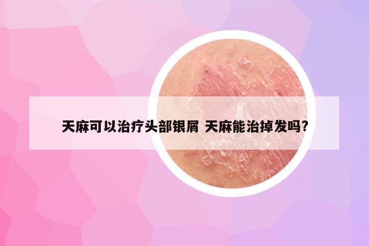 天麻可以治疗头部银屑 天麻能治掉发吗?