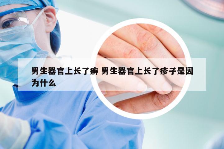 男生器官上长了癣 男生器官上长了疹子是因为什么