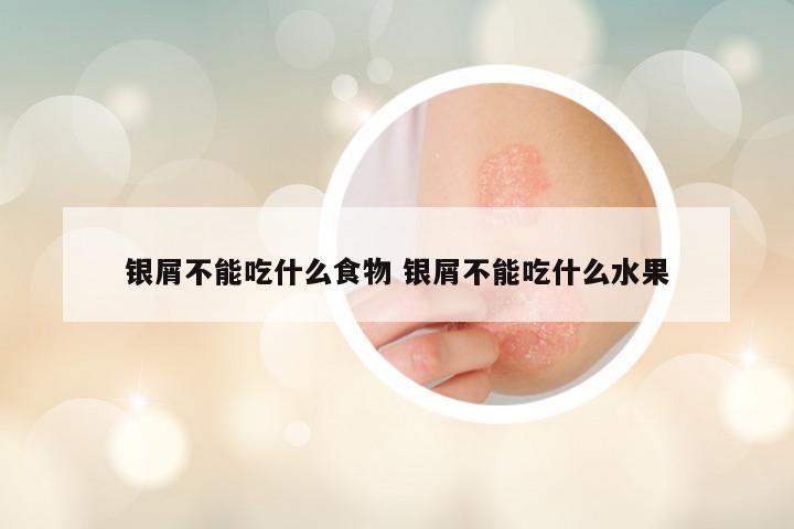 银屑不能吃什么食物 银屑不能吃什么水果