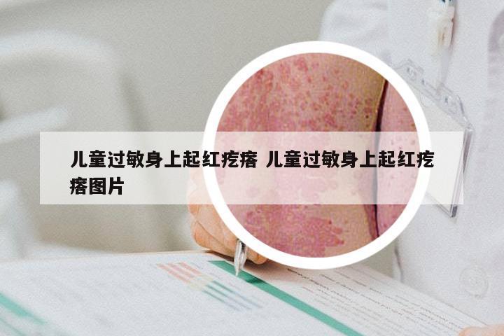 儿童过敏身上起红疙瘩 儿童过敏身上起红疙瘩图片