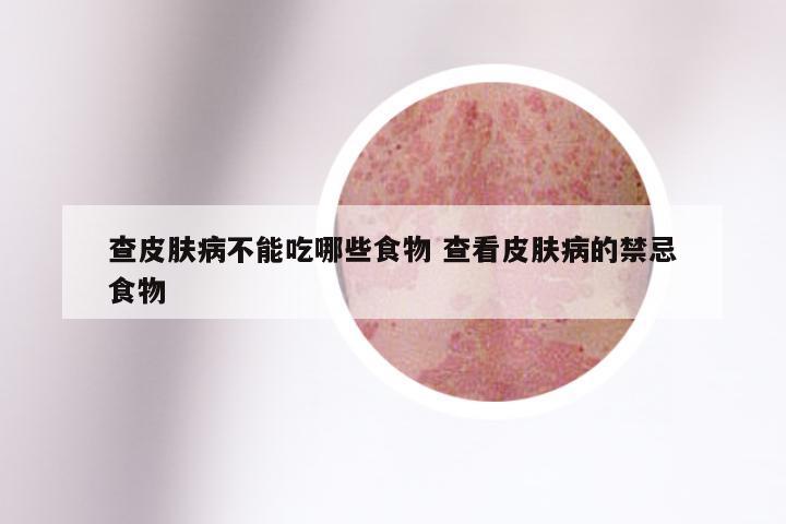 查皮肤病不能吃哪些食物 查看皮肤病的禁忌食物