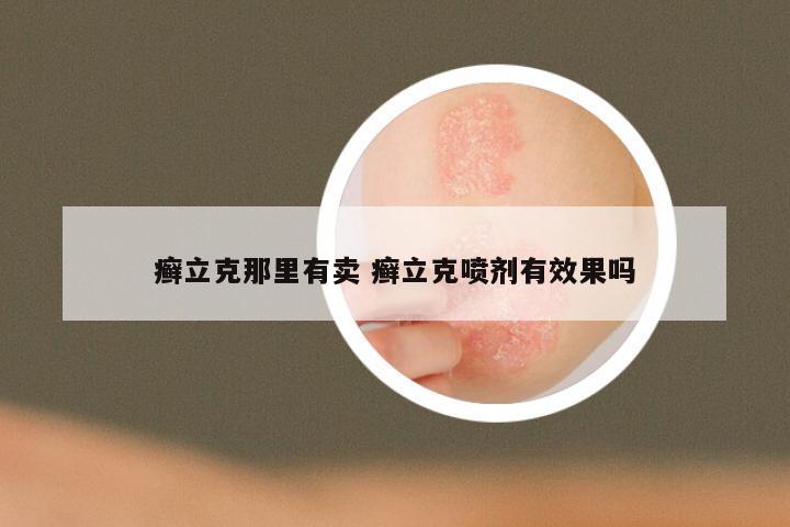 癣立克那里有卖 癣立克喷剂有效果吗