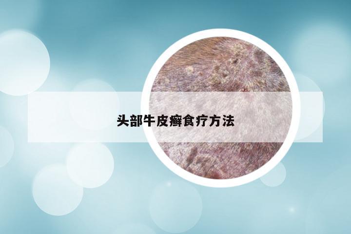 头部牛皮癣食疗方法