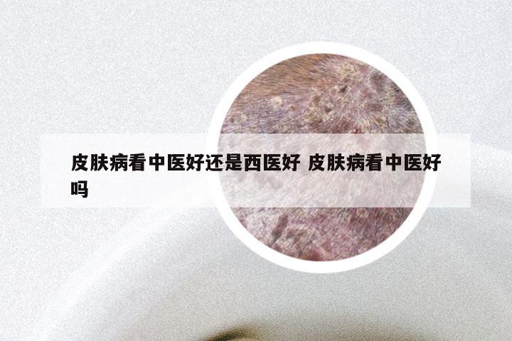 皮肤病看中医好还是西医好 皮肤病看中医好吗