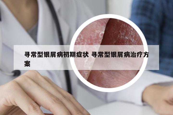 寻常型银屑病初期症状 寻常型银屑病治疗方案