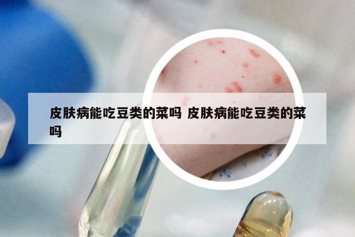 皮肤病能吃豆类的菜吗 皮肤病能吃豆类的菜吗