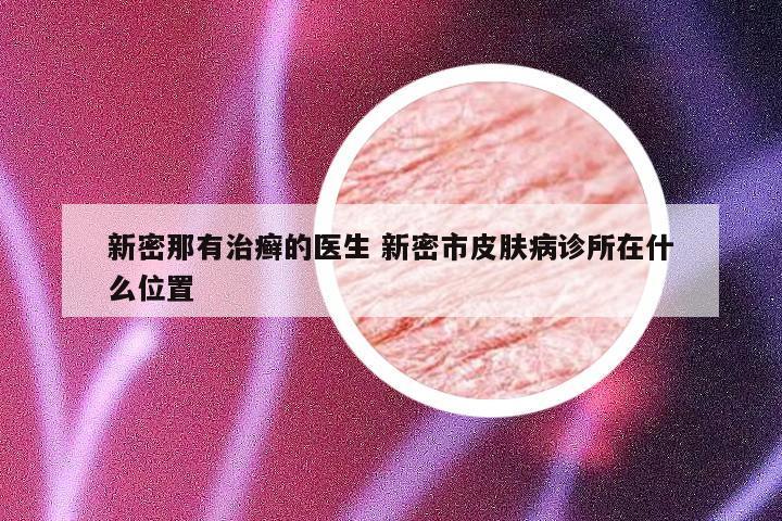 新密那有治癣的医生 新密市皮肤病诊所在什么位置