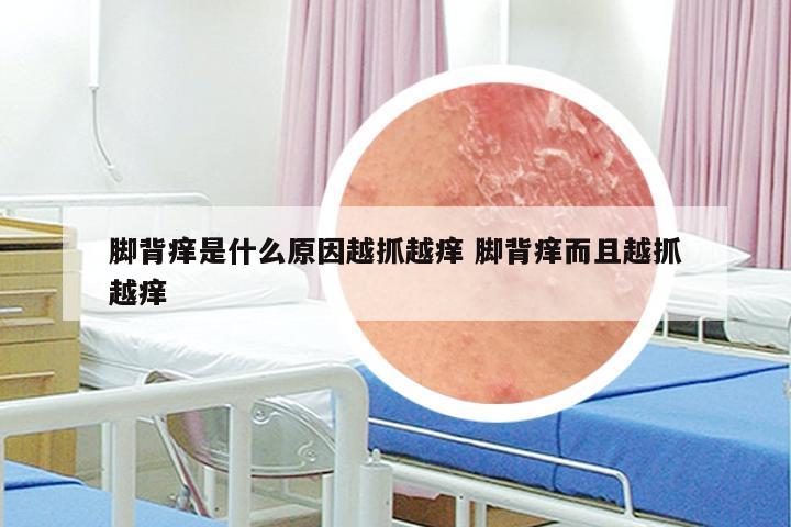 脚背痒是什么原因越抓越痒 脚背痒而且越抓越痒