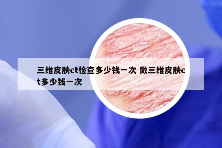 三维皮肤ct检查多少钱一次 做三维皮肤ct多少钱一次