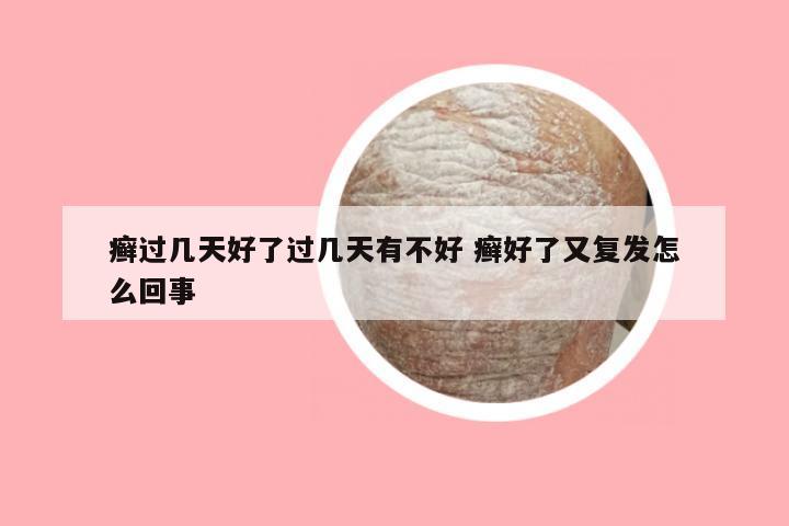 癣过几天好了过几天有不好 癣好了又复发怎么回事
