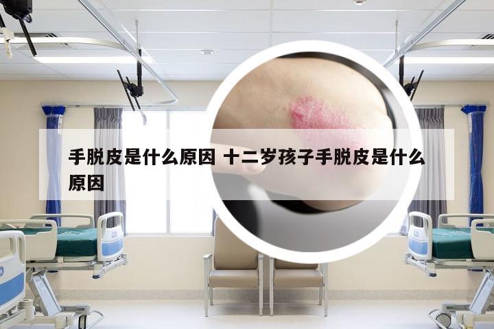 手脱皮是什么原因 十二岁孩子手脱皮是什么原因