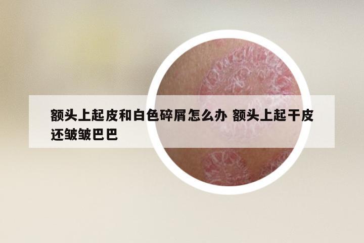 额头上起皮和白色碎屑怎么办 额头上起干皮还皱皱巴巴