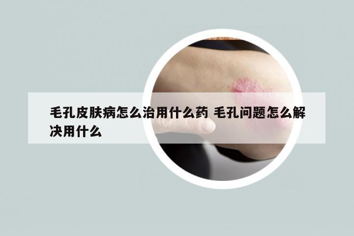 毛孔皮肤病怎么治用什么药 毛孔问题怎么解决用什么